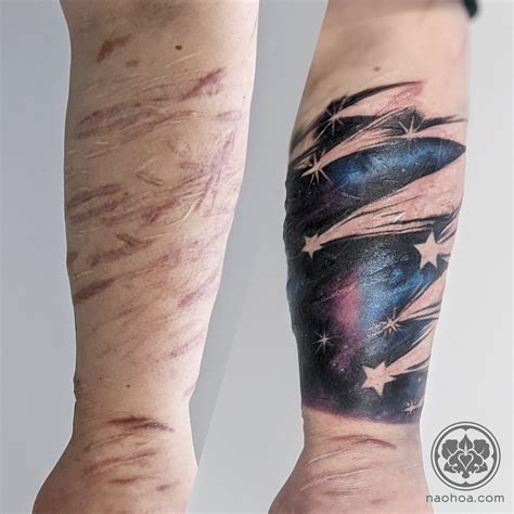 Tattooing Over Scars Naohoa