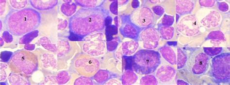 Single Myeloid Cells And Mature Neutrophils 1 Myeloblast 2