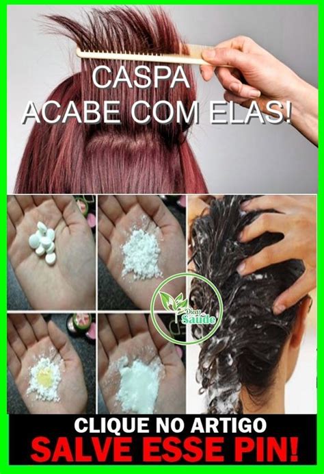 Coçeira No Couro Cabeludo E Queda De Cabelo Tratamento Caseiro