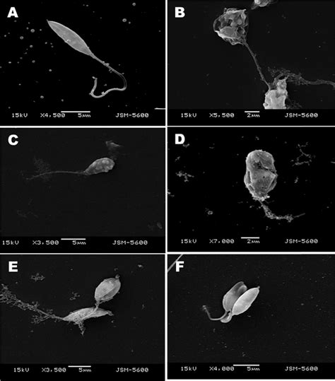 Electromicrographs Of Promastigote Forms Of Leishmania Infantum A Download Scientific Diagram