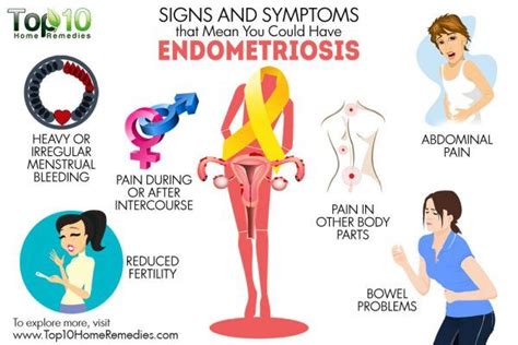 Current and future medical therapies vercellini p, et al. Signs and Symptoms that Mean You Could Have Endometriosis ...