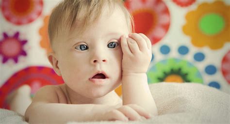 Babies With Down Syndrome Babycenter