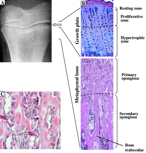 Growth Plate Diagram Histology Cartilage And Bone Skeletal System My