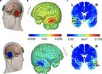 Frontiers Past Present And Future Of Non Invasive Brain Stimulation