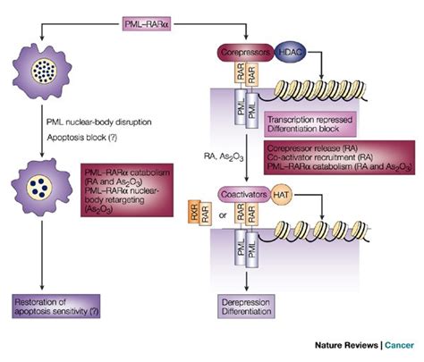 How Acute Promyelocytic Leukaemia Revived Arsenic Nature Reviews Cancer