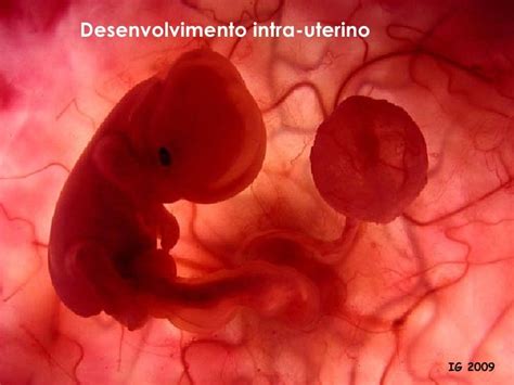 Desenvolvimento Intrauterino