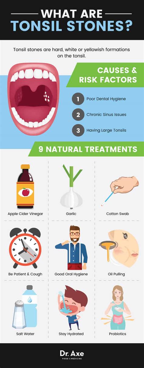 Tonsil Stones Symptoms 9 Natural Treatments Get Collagen