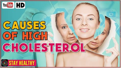 high chlesterol 7 remedies to get rid of cholesterol milk spots naturally labrislab