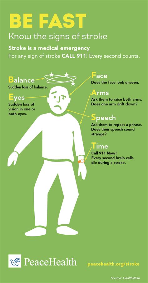 Infographic Signs Of A Stroke Peacehealth