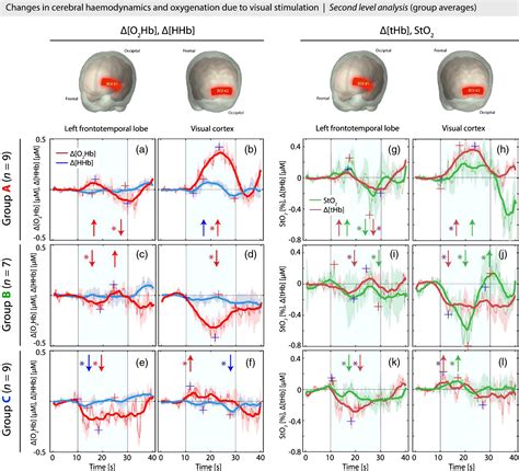 Cerebral Hemodynamic Responses In Preterm Born Neonates To Visual