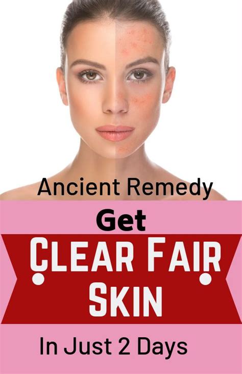 Ancient Trick To Get Clear Fair Skin In Just 2 Days Fairskin