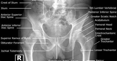 What is the collateral circulation after hypogastric artery ligation? Radiographic Anatomy - Pelvis AP Male | Radiographic ...