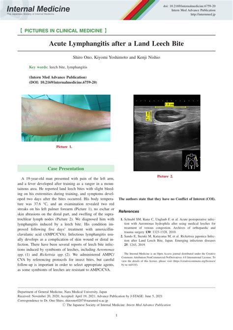 Pdf Acute Lymphangitis After A Land Leech Bite