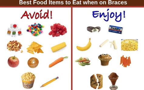 Foods You Can And Cant Eat With Braces Stavya Dental Clinic