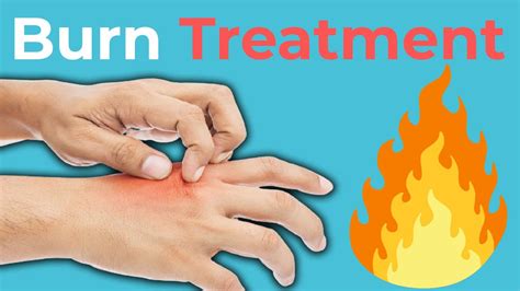 Burn Treatment Types Of Burns How To Treat Them YouTube