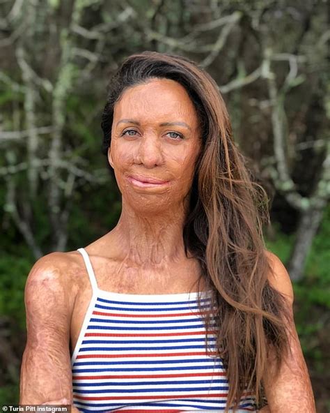 Turia Pitt Reveals How Life Has Changed Since The COVID Pandemic Hit Daily Mail Online