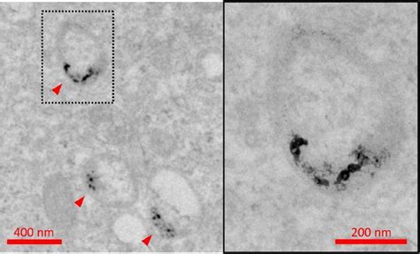 Tem Images Of Endosomes Containing Tin Nps Marked By Arrows Observed