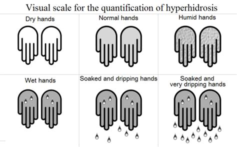 Hyperhidrosis Causes Symptoms Diagnosis And Treatments