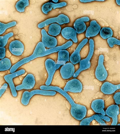 Marburg Virus Particles Colorized Transmission Electron Micrograph Of