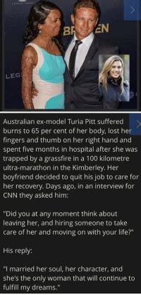 LEGI Australian Ex Model Turia Pitt Suffered Burns To Per Cent Of