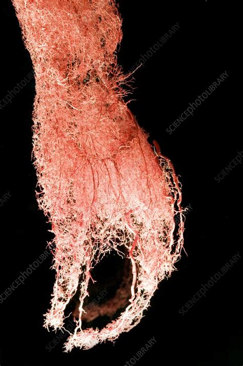 Plastinated Hand Blood Vessels Stock Image C0017098 Science