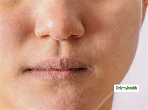 Skin Around Lips Lipstutorial Org