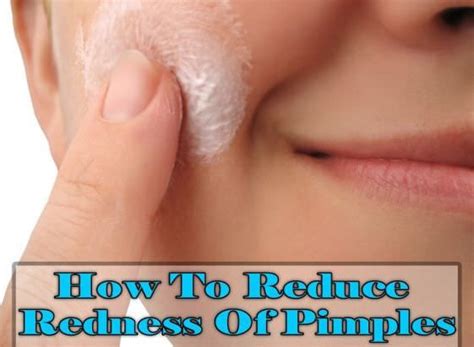 How To Reduce Pimple Redness Reduce Pimple Redness How To Reduce
