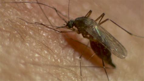 Image Mosquito Bite With West Nile Virus Reaction Peepsburghcom
