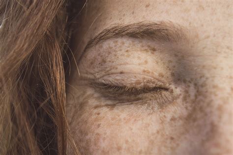 Dry Skin Around Eyes 7 Natural Solutions That Work Root Science