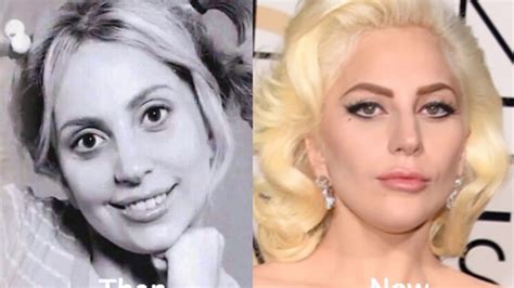 Top Amazing Celebrities Plastic Surgeries Before And After Youtube