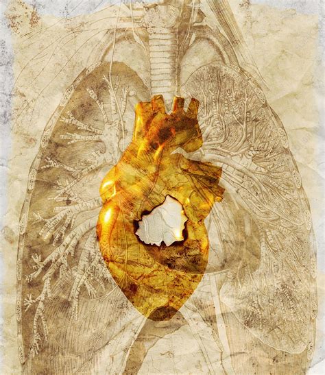 Diseased Heart Stock Image M1720549 Science Photo Library