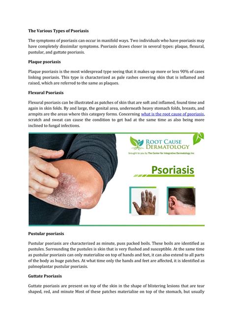 The Various Types Of Psoriasis By Root Cause Dermatology Issuu