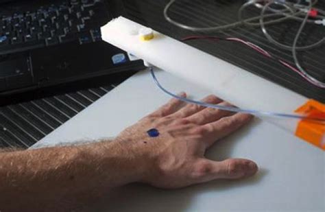 3d Printing Skin Cells Directly Onto Burn Wounds Design Indaba