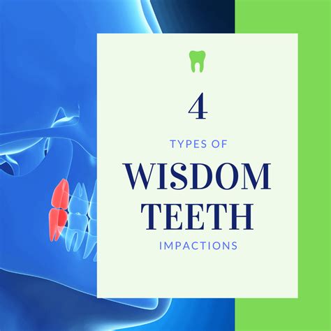 4 Types Of Wisdom Teeth Impactions Laurich Dentistry