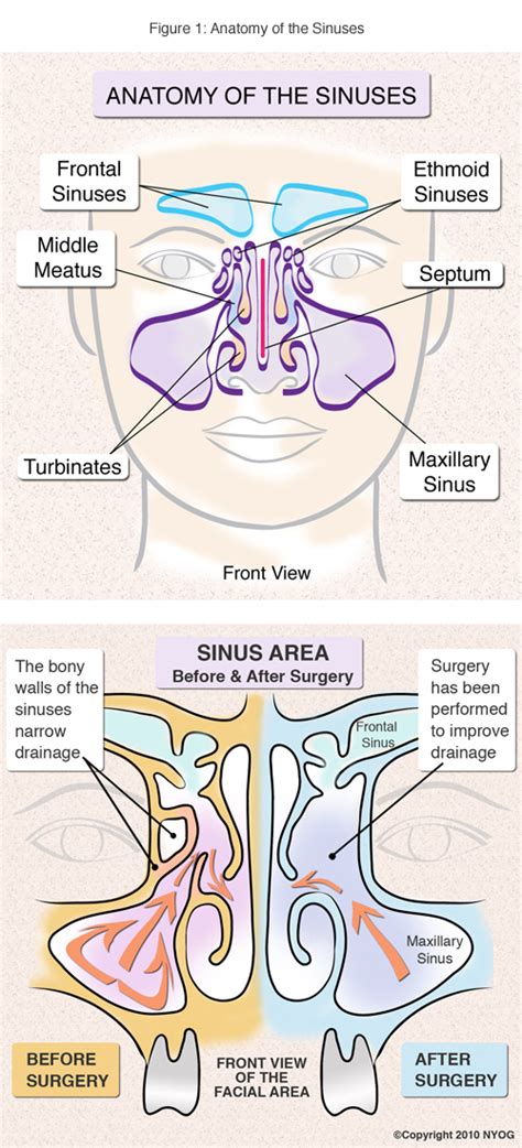 Sinus Anatomy Check Out This Helpful Diagram Ny Sinus Center
