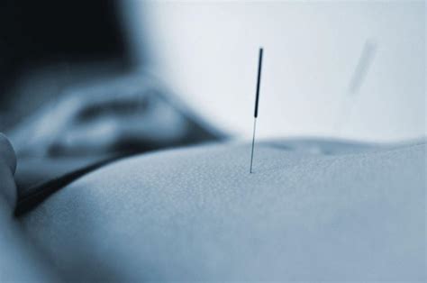 How Can Acupuncture Help Your 2019 Personal Fitness Programmes
