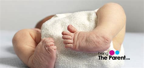 Crooked Feet In Babies Causes And Treatment Being The Parent