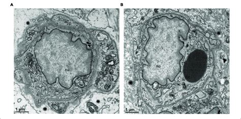 Transmission Electron Microscopy Of Blood Vessels From Md Specimens Download Scientific