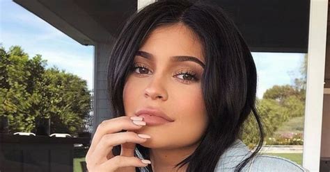 Kylie Jenner Stormi Allergic Reaction Famous Person