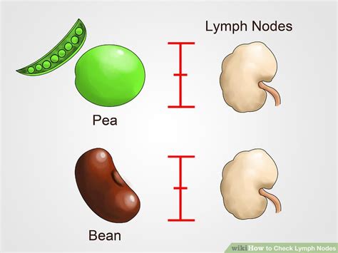 What Does Cancer In Neck Lymph Nodes Feel Like What Caused The