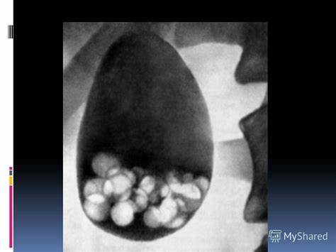 После болезни диета