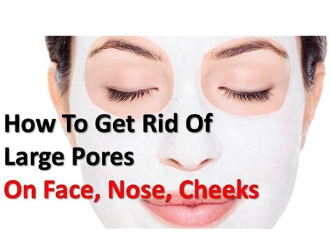 How To Get Rid Of Large Pores On Face Nose Cheeks Youtube