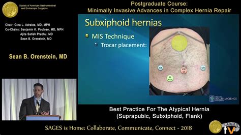 Best Practice For The Atypical Hernia Suprapubic Subxiphoid Flank