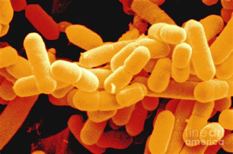 Listeria Monocytogenes Bacteria Photograph By Scimat Pixels