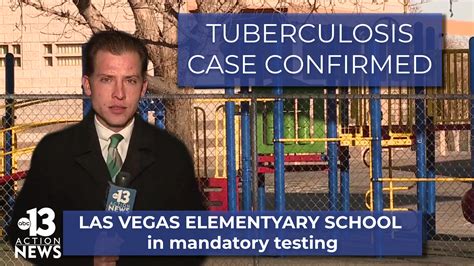 Tuberculosis Case Reported At Local Elementary School