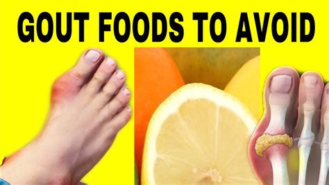 List of foods to avoid with gout flare up. Gout foods to avoid | Gout patients foods to avoid list ...