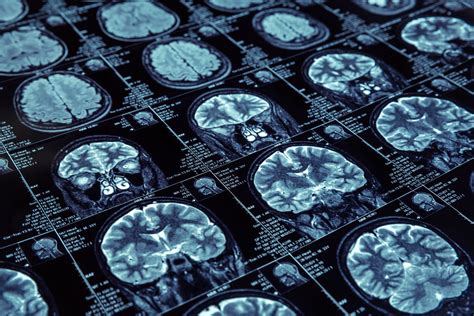 Simplifying Brain Imaging Data To Foster More Transparency Discoveries