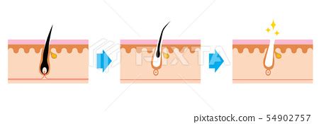 Cross Sectional View Of Hair Root Hair Scalp Stock Illustration