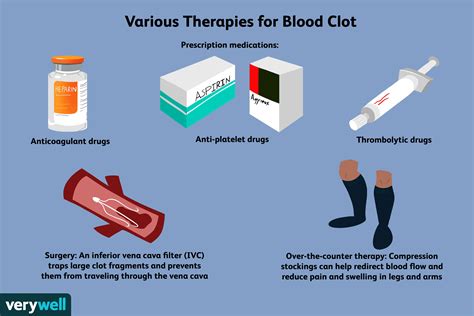 How To Cure A Blood Clot Trackreply4