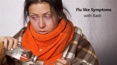 Flu Like Symptoms With Rash Morelia